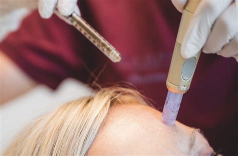 PrP Behandeling Voor Haar: Effectiviteit En Waardering